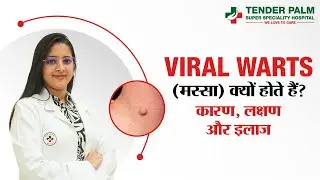 Viral Warts (Massay) Kya Hote Hain? Causes, Symptoms & Treatment | Dermatologist Explains