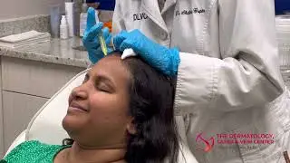 PRP, Microneedling and Exosomes for Hair Restoration | Dr. Shalini Gupta