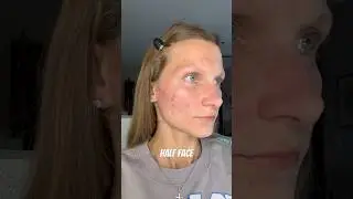 Do You Think Dr. Jart Cicapair Tiger Grass Color Correcting Treatment Lives Up to the Hype? #drjart