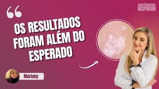 Líquen Escleroso: sintomas e tratamento - a história real de Mariany - HISTÓRIAS QUE INSPIRAM #25