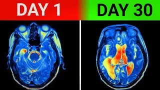 No Sugar for 30 Days... Here's 6 Shocking Results (Tamil)