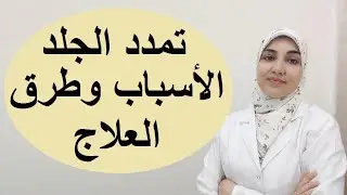 علامات تمدد الجلد وأنواعها وأسبابها وطرق علاجها؟