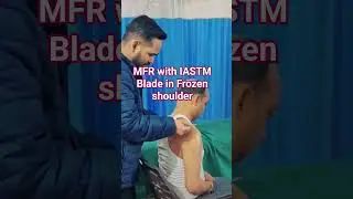Frozen Shoulder Open Karne ka Powerful Treatment 😱 | MFR + IASTM