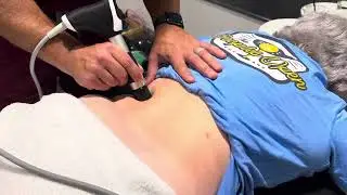 New Shockwave Therapy for low back pain/sciatica 