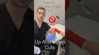 How To Remove A Cast: Part 1 #shorts #casting #ortho