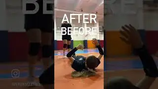 AFTER -BEFORE🥲#volleyball #zehragunes #sports #voleybol #pendik #volleyballplayer #kurtk&ouml;y #shorts
