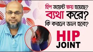 হিপ জয়েন্ট ক্ষয় হয়েছে? ব্যথা করে? কি করলে ভাল হবে? Hip Joint Pain, Hip Joint Treatment
