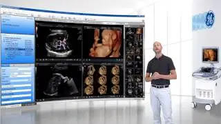 ViewPoint 6 - Ultrasound PACS and Reporting
