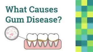 Gum Disease in Sherman, TX - Collins Family Dentistry