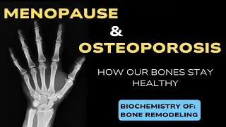 Menopause & Osteoporosis: How Your Bones Stay Healthy | Biochemistry of Bone Remodeling Explained