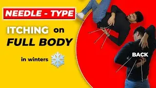 Winter skin Problems | Winters Body Care Routine | Itching in Winters | Dry Skin | Sahil Gera
