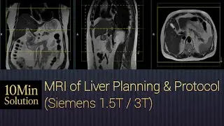 MRI of Liver Planning Step by Step | Siemens 1.5T & 3T Protocol