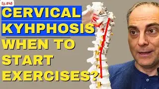 Ep46 Can I Do Exericise with Cervical Kyphosis, Disc Desiccation, Posterior Disc Bulge (C5-C6, C6-C7