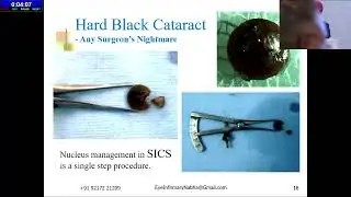 AIOCMT3 2024   GP8 topic   Dr DHALIWAL RANJIT SINGH Manual SICS   Surgery for all seasons and reason