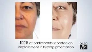 Brighten Your Skin in 5 Days!