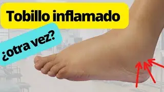 se te volvieron a INFLAMAR LOS TOBILLOS?
