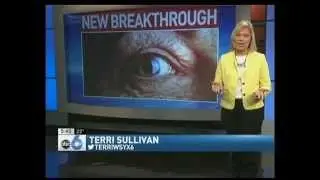 Dropless Cataract Surgery - Erdey Searcy Eye Group Columbus Ohio