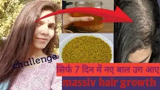 Challenge -Dana methi se  Sirf 7 din mein hair growth/ home made diy for hair regrowth/