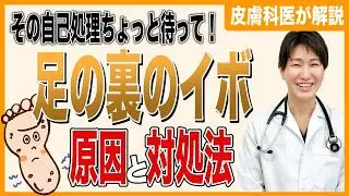 尋常性疣贅（じんじょうせいゆうぜい）とは？うつる場所・治療法・予防を皮膚科専門医が解説