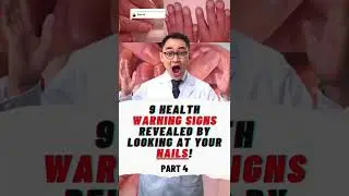 9 HEALTH WARNING SIGNS REVEALED BY LOOKING AT YOUR NAILS!  Part 4 #shorts