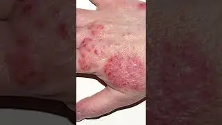 Вредит ли жесткая вода?
