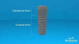 BioInfinity Dental Implant System