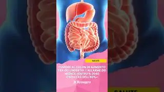 Tumore al colon in aumento tra gli under 50. L'allarme dei medici: &laquo;Entro il 2040 crescer&agrave; dell'80%&raquo;