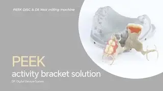 PEEK activity bracket solution