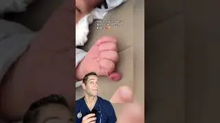 Doctor Reacts: born with an extra finger