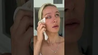 Normalize normal skin 🤍 #selflove #beautystandards #normalizenormalskin #acne #models