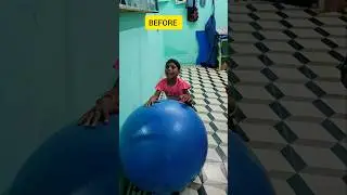 #bhuvikatv #physiotherapist #physiotherapy #physicaltherapy #shortsfeed #shorts
