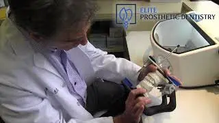 What is an Abutment in Relation to Dental Crowns?