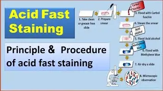 Acid Fast Staining | Staining | Differential Staining | Staining process