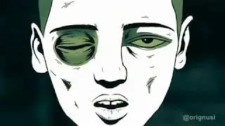🎵BONES - BLACK MOLD