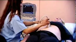 Abdominal Aortic Aneurysm  - Health Screening - Life Line Screening