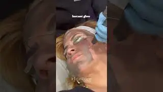 🎥 Let&rsquo;s talk Hollywood Spectra Carbon Laser Peel ✨ The go-to glow-up treatment loved by celebs, and