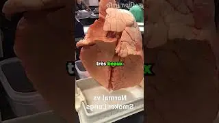 VOICI POURQUOI VOUS DEVEZ ARRETER DE FUMER !😱