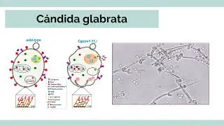 Bacterias y Hongos causantes de enfermedades orales