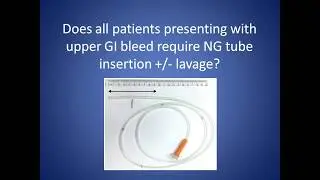 Does all patients presenting with upper GI bleed require NG tube insertion +/- lavage? (W.no.6/2020)