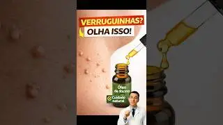 Verruguinhas no Pesco&ccedil;o? Veja o Cuidado Caseiro Mais Comentado!  #dicas #foryou #shorts  #saude
