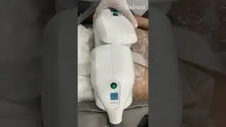 Fat Freezing Treatment at Skinaa Clinic | Achieve Your Dream Body with Advanced Technology #viral