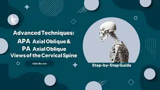 Advanced Techniques: APA Axial Oblique & PA Axial Oblique Views of the Cervical Spine