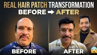 Arhan Hair solution #shorts 