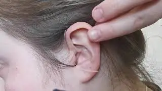 Как вставить слуховой аппарат