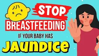 Stop Breastfeeding if Your Baby Has Jaundice? (NO! Here’s What You Need to Know)