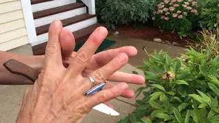How To Remove A Bee Stinger