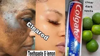 Colgate toothpaste for face whitening   Lemon and colgate 1
