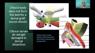 Female Urethral Stricture Diagnosis ad Treatment Overview 2022