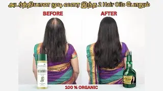 அடர்த்தியான முடி வளர இந்த 2 Hair Oils போதும் |Kesh King Ayurvedic vs Biotique Bio Bringhraj Hair Oil