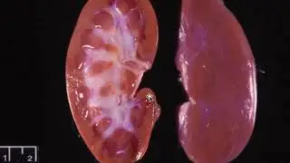 Gross Pathology of the Urinary System 1 - Introduction